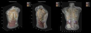 Midjourney crée un nouveau scanner corporel à ultrasons