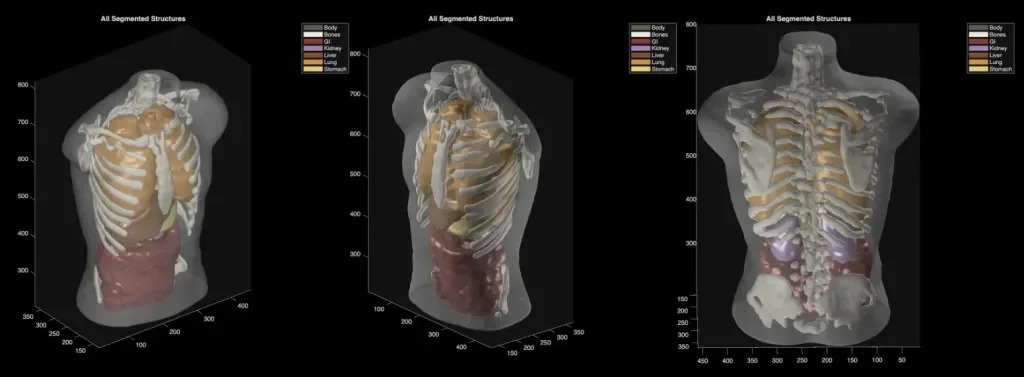 Midjourney crée un nouveau scanner corporel à ultrasons
